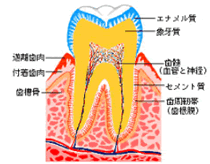 歯周病図解